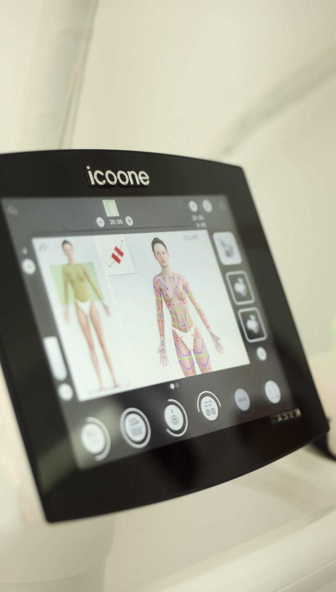 ICOONE Laser